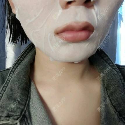 更美 - (๑乛◡乛๑)的除皱瘦脸经验 | 除皱瘦脸 | 南京