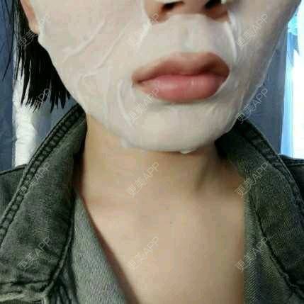 更美 - (๑乛◡乛๑)的除皱瘦脸经验 | 除皱瘦脸 | 南京