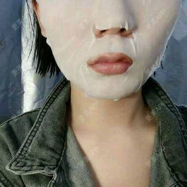 更美 - (๑乛◡乛๑)的除皱瘦脸经验 | 除皱瘦脸 | 南京