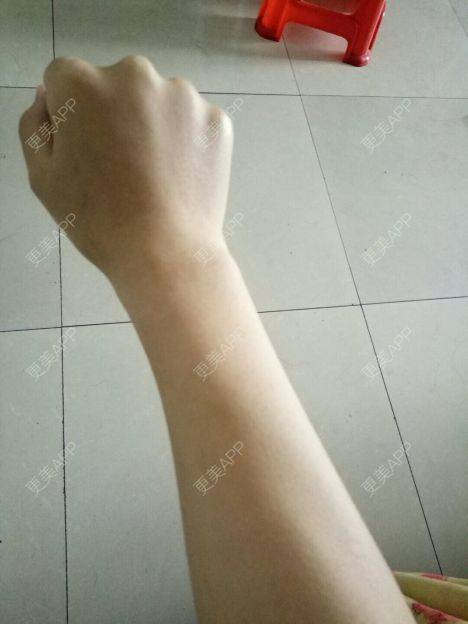 更美 - 更美用户UR3P7ZKswU的大腿脱毛经验 | 手臂脱毛 | 大腿脱毛 | 脱唇毛 | 激光脱腋毛 | 贵阳