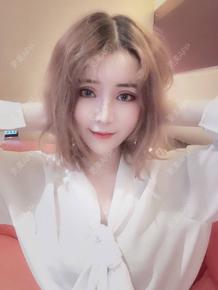 更美 - 幕大大的厚唇改薄经验 | 唇腭裂修复 | 开内眼角 | 开外眼角 | 厚唇改薄 | 玻尿酸唇部 | 自体脂肪丰唇 | 成都 | 注射美白 | M唇成形 | 超声提升 | 半永久妆 | 唇综合