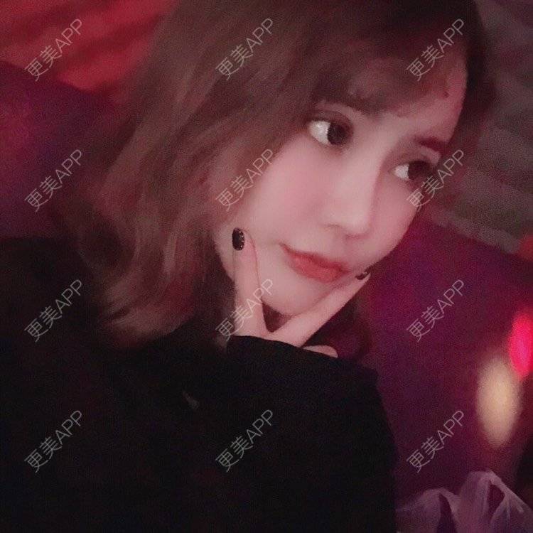 更美 - 幕大大的厚唇改薄经验 | 唇腭裂修复 | 开内眼角 | 开外眼角 | 厚唇改薄 | 玻尿酸唇部 | 自体脂肪丰唇 | 成都 | 注射美白 | M唇成形 | 超声提升 | 半永久妆 | 唇综合