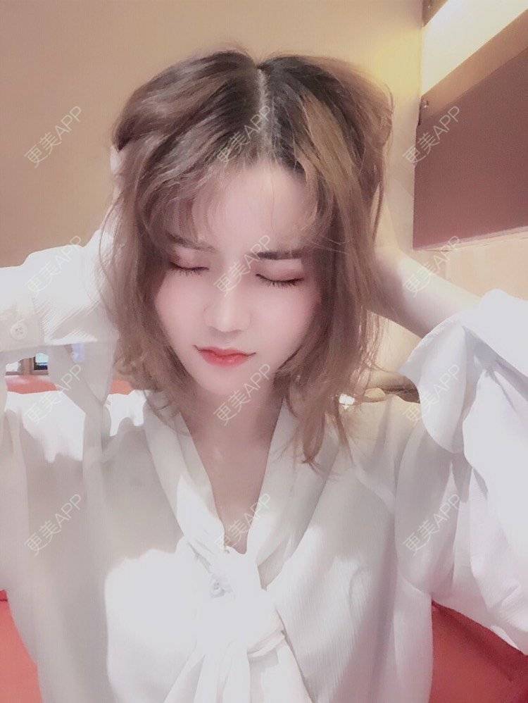 更美 - 幕大大的厚唇改薄经验 | 唇腭裂修复 | 开内眼角 | 开外眼角 | 厚唇改薄 | 玻尿酸唇部 | 自体脂肪丰唇 | 成都 | 注射美白 | M唇成形 | 超声提升 | 半永久妆 | 唇综合