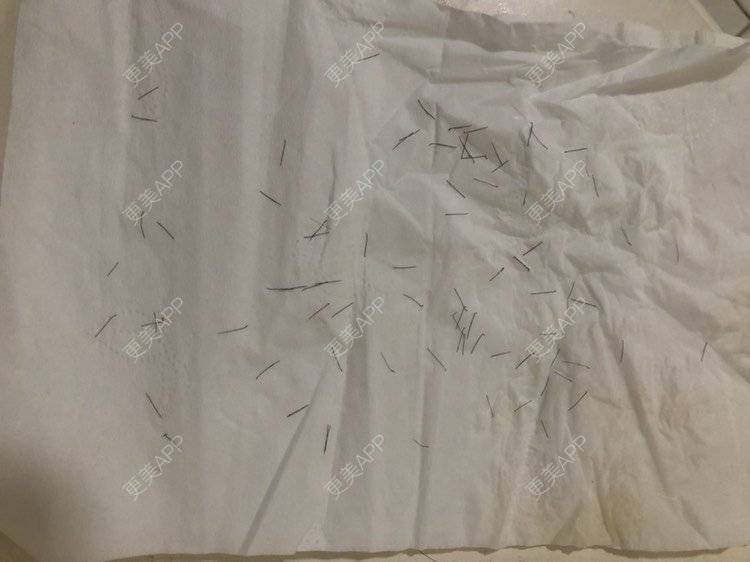 更美 - 奥多Ke。的植发际线经验 | 植发际线 | 南昌