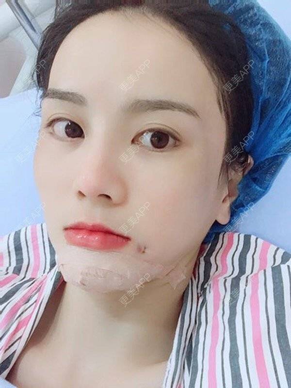 肉圆子的酒窝日记