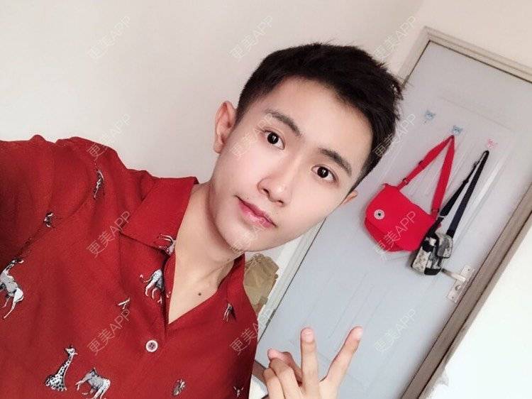 更美 - Ewww时的面部脱毛经验 | 厚唇改薄 | 唇综合 | 唇腭裂修复 | 隆鼻 | 面部脱毛 | 玻尿酸唇部 | 成都 | 注射美白 | 超声提升 | 半永久妆 | 视频日记