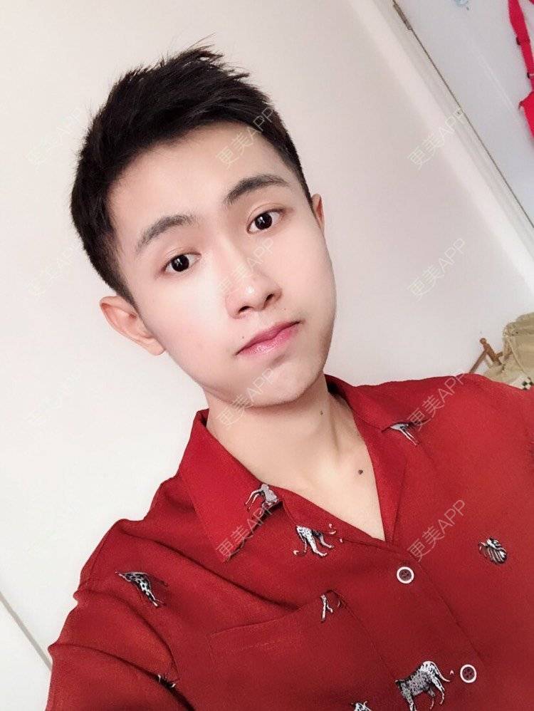 更美 - Ewww时的面部脱毛经验 | 厚唇改薄 | 唇综合 | 唇腭裂修复 | 隆鼻 | 面部脱毛 | 玻尿酸唇部 | 成都 | 注射美白 | 超声提升 | 半永久妆 | 视频日记