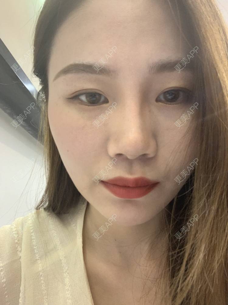 更美 - ahah的牙齿矫正经验 | 牙齿矫正 | 广州