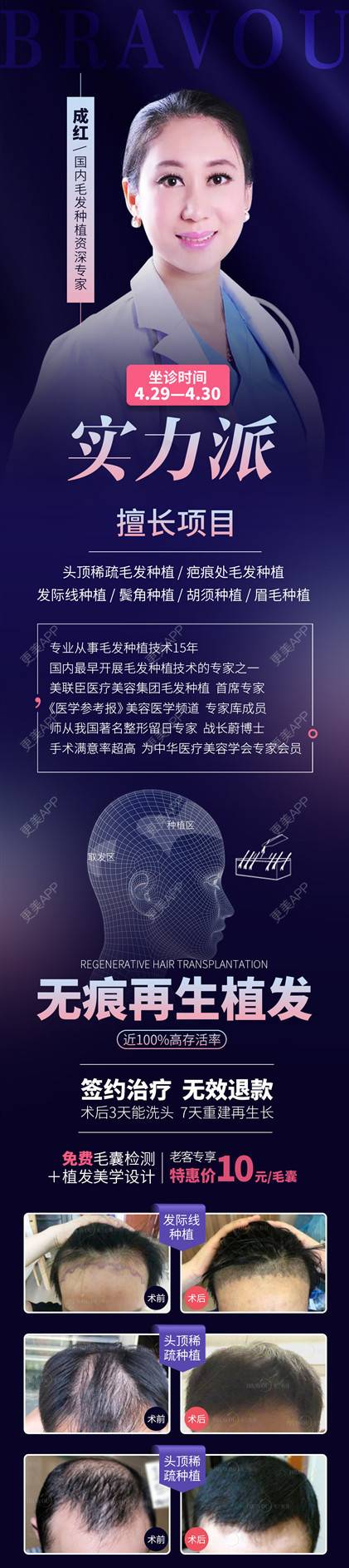 更美 - 深圳米兰柏羽医疗美容医院的经验 | 深圳