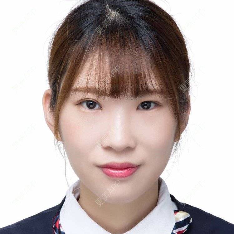 更美 - 更美用户amzIQiOcdr的鼻部膨体假体取出经验 | 肋软骨隆鼻 | 鼻部膨体假体取出 | 自体肋软骨垫鼻基底 | 全脸整形套餐