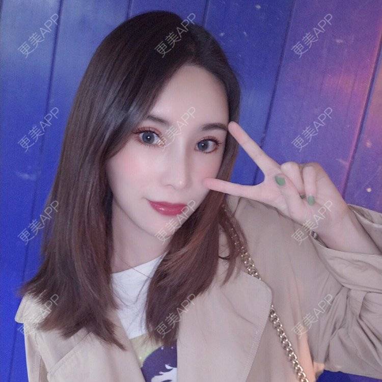 更美 - 更美用户amzIQiOcdr的鼻部膨体假体取出经验 | 肋软骨隆鼻 | 鼻部膨体假体取出 | 自体肋软骨垫鼻基底 | 全脸整形套餐