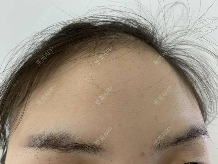 更美 - 更美用户bh8pAMDbJ6的洗眼线经验 | 洗眼线 | 郑州