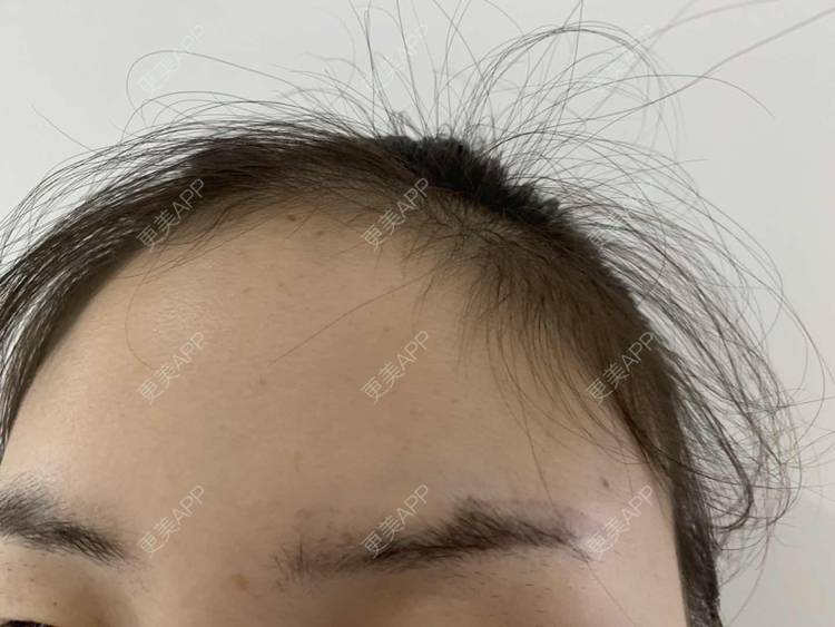更美 - 更美用户bh8pAMDbJ6的洗眼线经验 | 洗眼线 | 郑州
