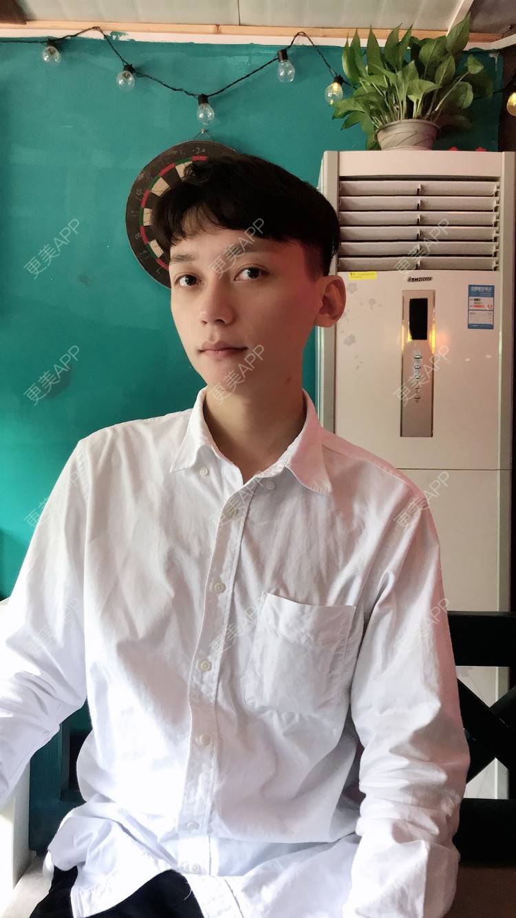 更美 - 幽默的超人的玻尿酸下巴经验 | 玻尿酸下巴 | 自体脂肪垫下巴 | 硅胶垫下巴 | 膨体垫下巴 | 胶原蛋白丰下巴 | 重庆