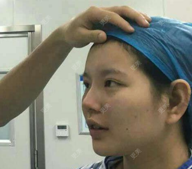 大麦微针植发丨全国连锁(昆明分院)