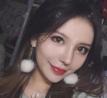 大麦微针植发丨全国连锁(昆明分院)