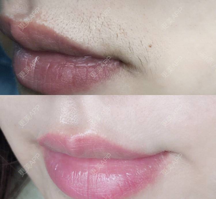 更美用户luqwqry7he的脱唇毛日记