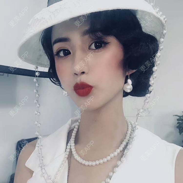 更美 - 今天可爱百分百的自体脂肪丰苹果肌经验 | 自体脂肪丰苹果肌 | 自体脂肪全面部填充 | 自体脂肪丰面颊 | 自体脂肪丰太阳穴 | 杭州 | 自体脂肪丰额头