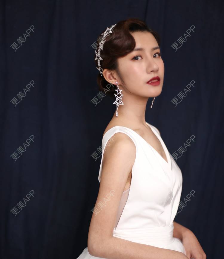 更美 - 今天可爱百分百的自体脂肪丰苹果肌经验 | 自体脂肪丰苹果肌 | 自体脂肪全面部填充 | 自体脂肪丰面颊 | 自体脂肪丰太阳穴 | 杭州 | 自体脂肪丰额头