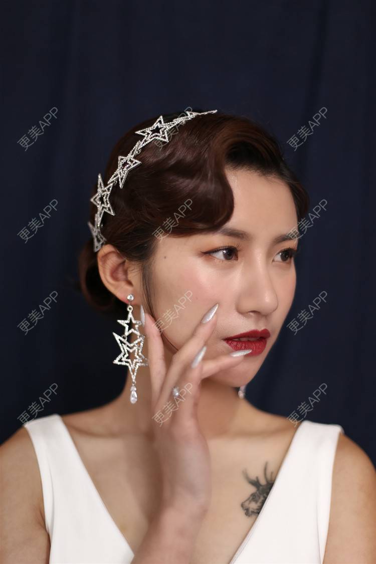 更美 - 今天可爱百分百的自体脂肪丰苹果肌经验 | 自体脂肪丰苹果肌 | 自体脂肪全面部填充 | 自体脂肪丰面颊 | 自体脂肪丰太阳穴 | 杭州 | 自体脂肪丰额头