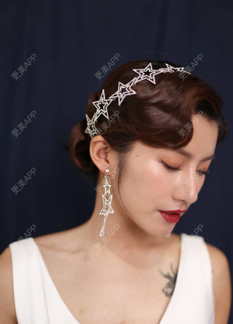 更美 - 今天可爱百分百的自体脂肪丰苹果肌经验 | 自体脂肪丰苹果肌 | 自体脂肪全面部填充 | 自体脂肪丰面颊 | 自体脂肪丰太阳穴 | 杭州 | 自体脂肪丰额头