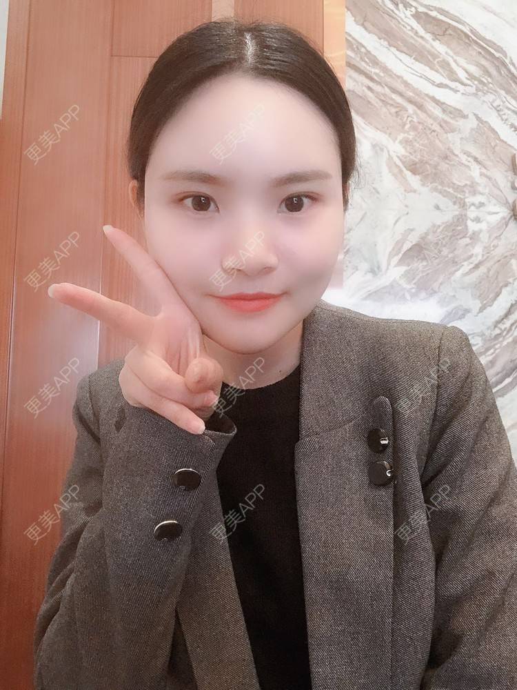 更美 - 大美人图的硅胶垫下巴经验 | 更美研究所 | 杭州 | 硅胶垫下巴