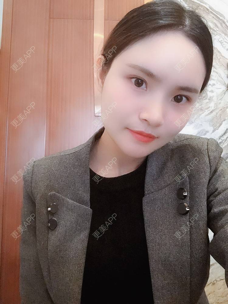 更美 - 大美人图的硅胶垫下巴经验 | 更美研究所 | 杭州 | 硅胶垫下巴