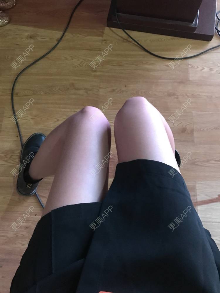 更美 - 更美用户L3kt4Nk0xw的激光紧缩阴道经验 | 激光紧缩阴道 | 成都