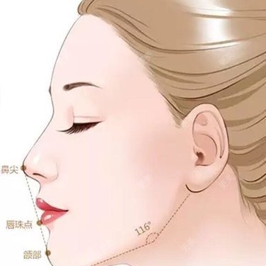 双眼皮