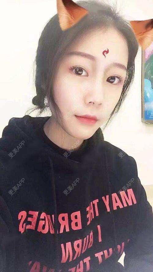 更美 - 更美用户kE4AUQaVC3的吸脂瘦脸经验 | 天津 | 吸脂瘦脸
