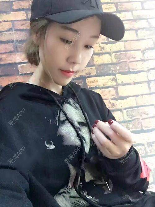 更美 - 更美用户kE4AUQaVC3的吸脂瘦脸经验 | 天津 | 吸脂瘦脸