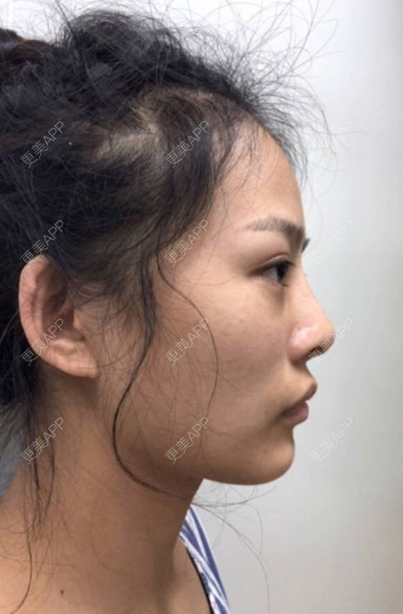更美 - 怀拥你的鼻部多项经验 | 鼻部多项 | 南京