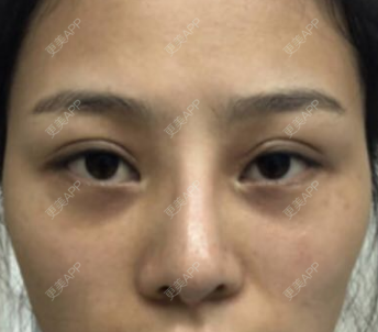 更美 - 怀拥你的鼻部多项经验 | 鼻部多项 | 南京