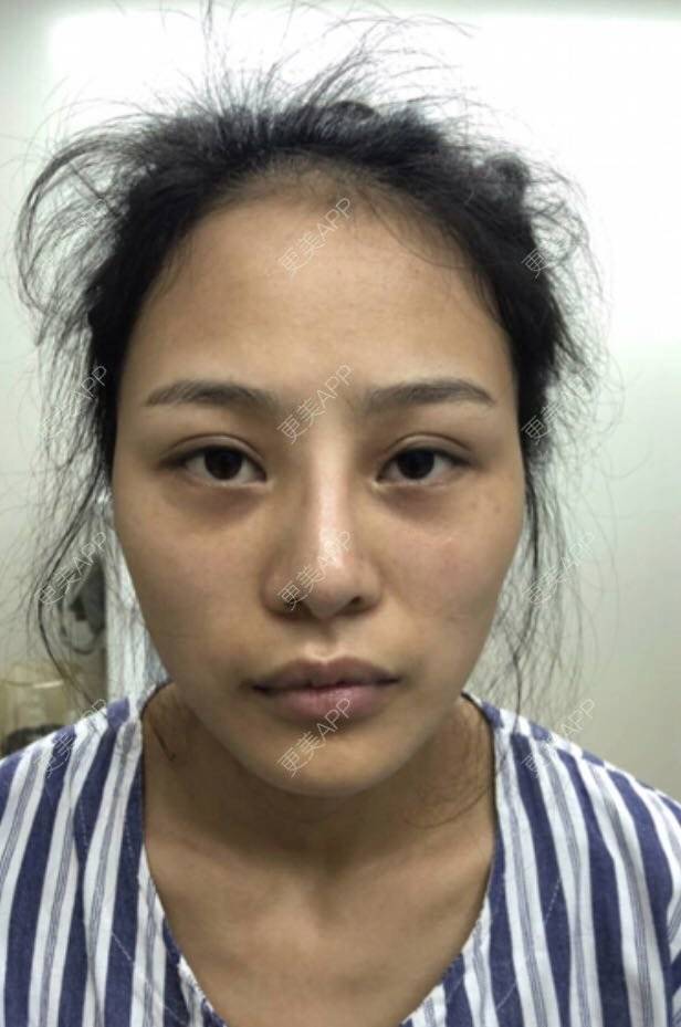更美 - 怀拥你的鼻部多项经验 | 鼻部多项 | 南京