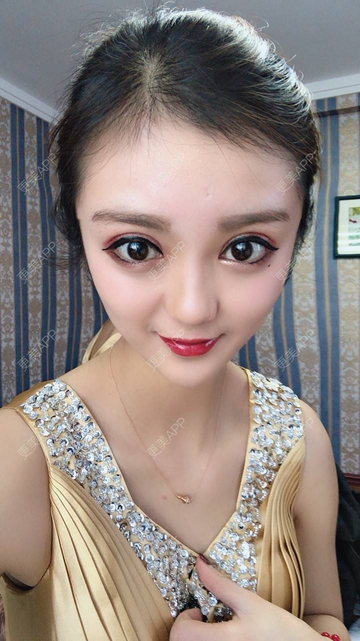 ◣梦惊人离◢豪的眼部综合日记