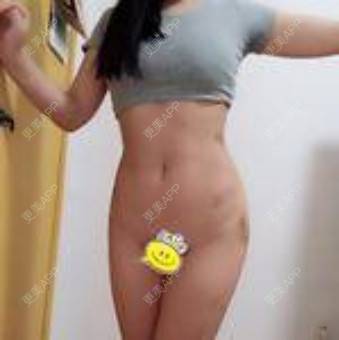 更美 - 陶宏炜 医生的自体脂肪丰臀经验 | 自体脂肪丰臀 | 上海