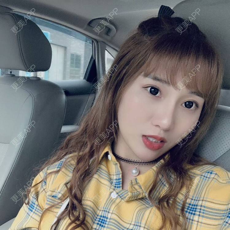 更美 - 我的郭靖的隆鼻经验 | 硅胶隆鼻 | 鼻翼缩小 | 鼻部多项 | 鼻部综合 | 隆鼻 | 自体软骨垫鼻尖 | 温州 | 耳软骨隆鼻