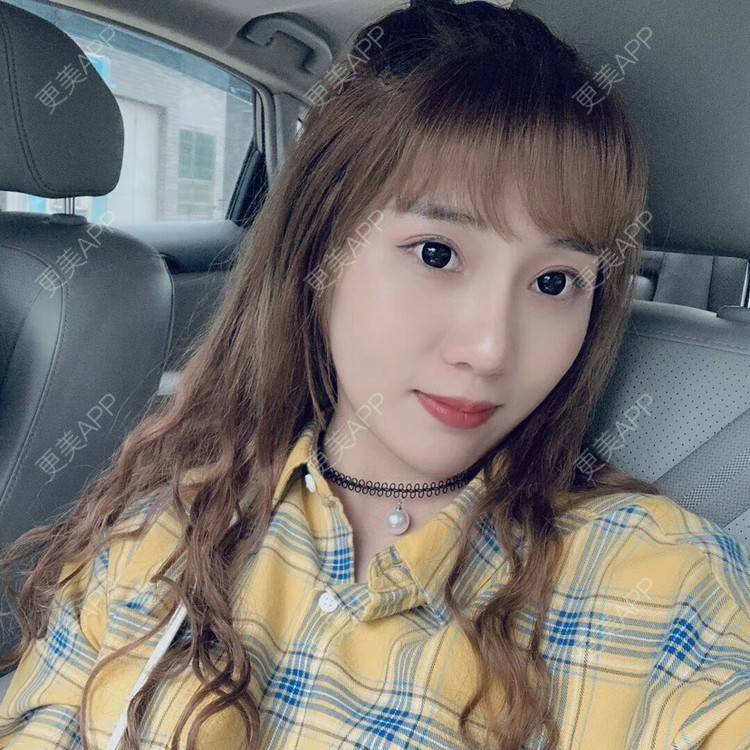 更美 - 我的郭靖的隆鼻经验 | 硅胶隆鼻 | 鼻翼缩小 | 鼻部多项 | 鼻部综合 | 隆鼻 | 自体软骨垫鼻尖 | 温州 | 耳软骨隆鼻