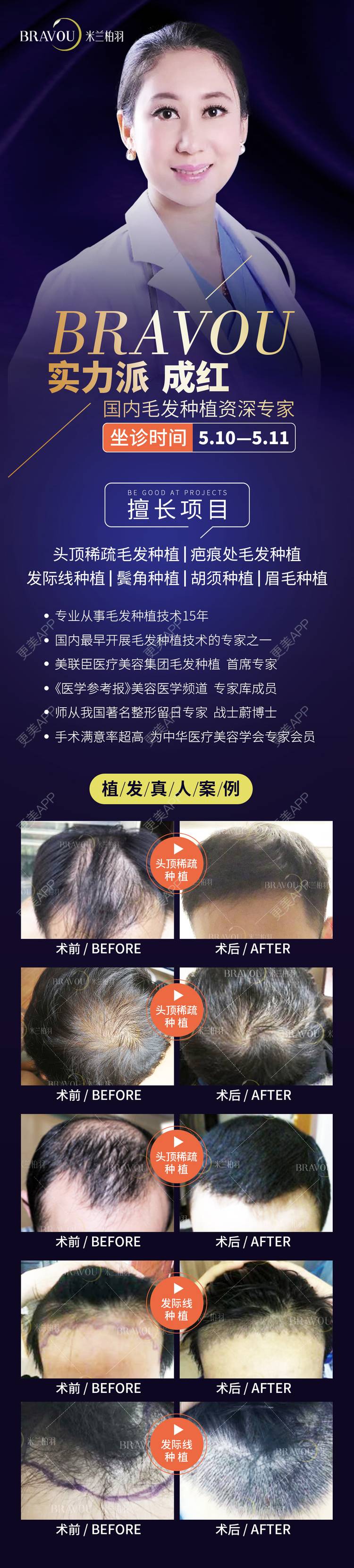 更美 - 深圳米兰柏羽医疗美容医院的经验 | 深圳