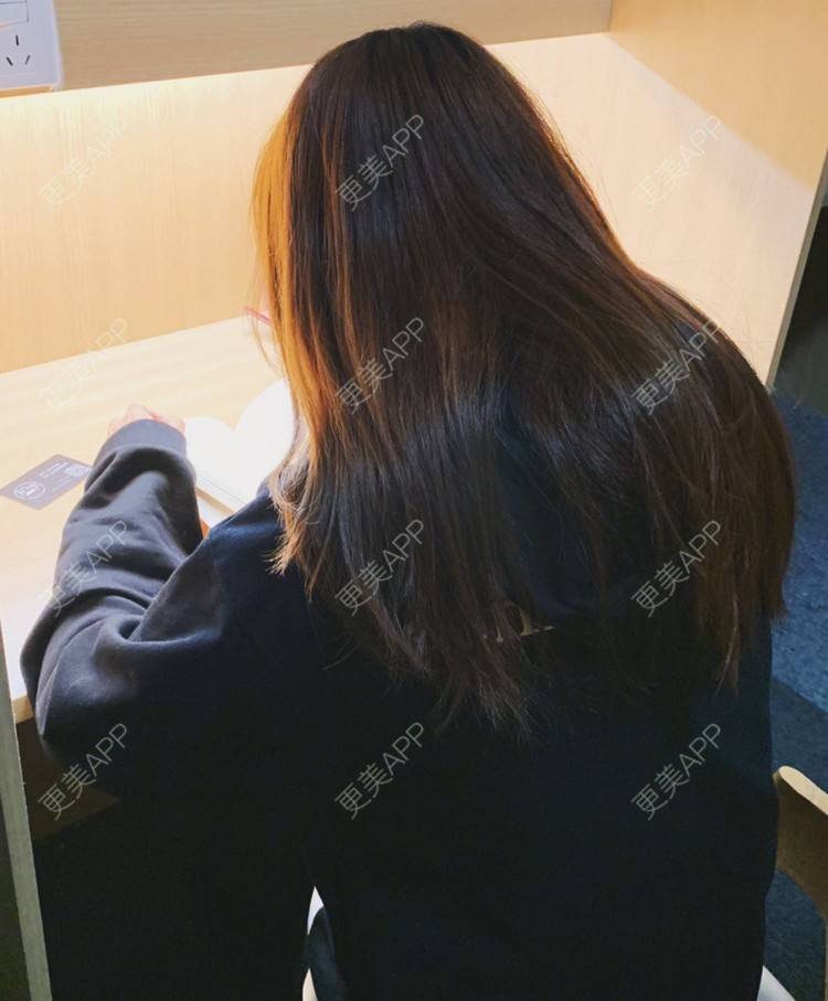 更美 - 大甜甜甜圈的肋软骨隆鼻经验 | 手术缩鼻头 | 上海 | 肋软骨隆鼻 | 鼻部综合