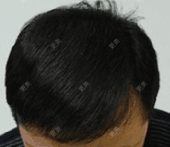直戳痛处.