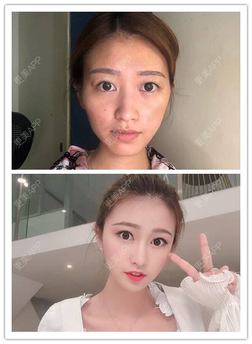 更美 - 康华清医疗美容门诊部的经验 | 广州
