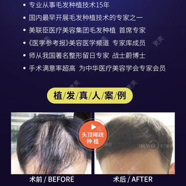 深圳米兰柏羽医疗美容医院