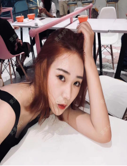 更美 - 更美用户Qy1yKR4Cba的胶原蛋白丰泪沟经验 | 胶原蛋白丰泪沟