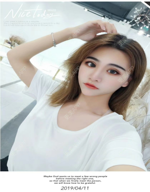 更美 - 更美用户2KQGdHvbnC的胶原蛋白丰泪沟经验 | 胶原蛋白丰泪沟