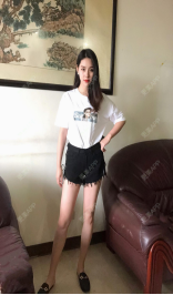 更美 - 更美用户5qUxIAqPaZ的胶原蛋白丰面颊经验 | 胶原蛋白丰面颊