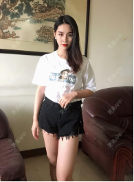 更美 - 更美用户5qUxIAqPaZ的胶原蛋白丰面颊经验 | 胶原蛋白丰面颊