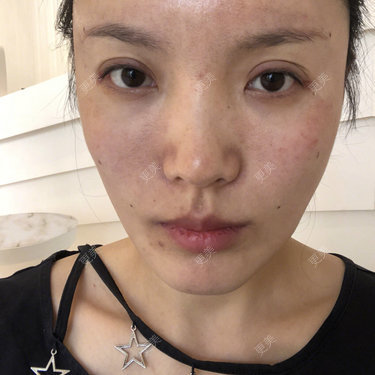 更美用户Cq0Cts6778