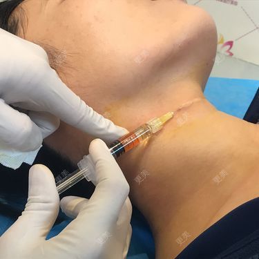 更美用户WBN3QBuHad