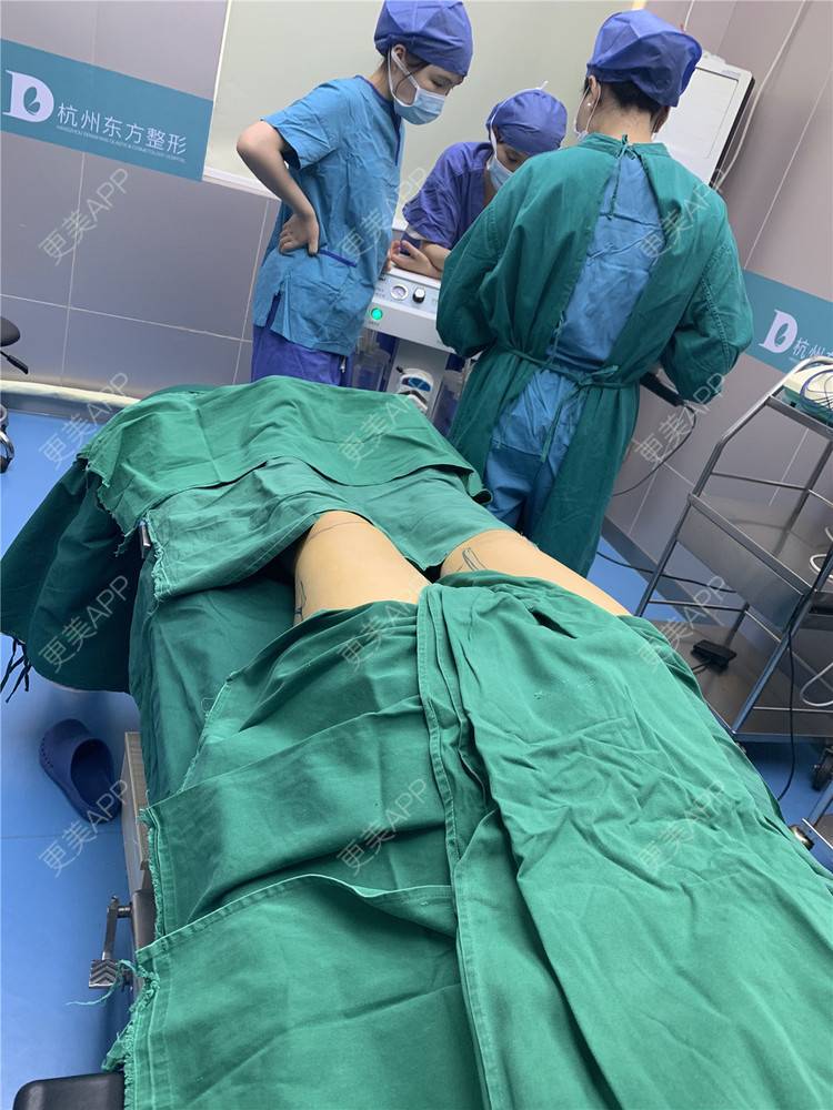 吸脂瘦大腿手术_更美用户igegmyjepg吸脂瘦大腿手术_更美整形